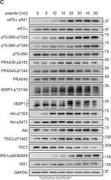 Anti-p70 S6K (phospho Thr229) antibody used in Western Blot (WB). GTX25231