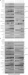 Anti-p70 S6K (phospho Thr229) antibody used in Western Blot (WB). GTX25231