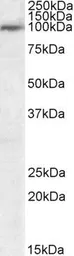 Anti-USP20 antibody, C-term used in Western Blot (WB). GTX25272