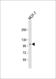 Anti-DDR1 antibody used in Western Blot (WB). GTX25508