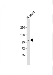 Anti-DDR1 antibody used in Western Blot (WB). GTX25508