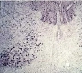 Anti-Parkin antibody used in IHC (Paraffin sections) (IHC-P). GTX25667