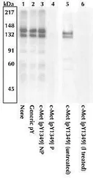 Anti-c-Met (phospho Tyr1349) antibody used in Western Blot (WB). GTX25669