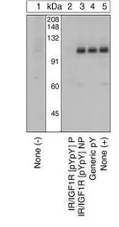 Anti-IGF1R beta (phospho Tyr1135 / Tyr1136) / Insulin Receptor beta (phospho Tyr1150 / Tyr1151) antibody used in Western Blot (WB). GTX25680