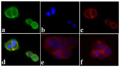 Anti-IGF1R beta (phospho Tyr1135 / Tyr1136) / Insulin Receptor beta (phospho Tyr1150 / Tyr1151) antibody used in Immunocytochemistry/ Immunofluorescence (ICC/IF). GTX25680