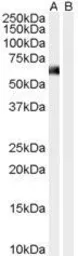 Anti-Syntrophin alpha 1 antibody, N-term used in Western Blot (WB). GTX25941