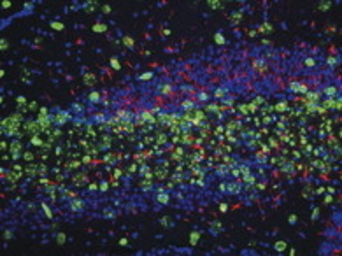 Anti-Nestin antibody [2Q178] used in Immunohistochemistry (IHC). GTX26142