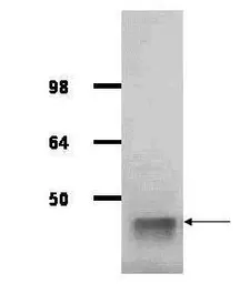 Anti-Aldolase A antibody used in Western Blot (WB). GTX26190