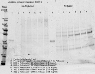 Anti-Aldolase A antibody used in Immunoprecipitation (IP). GTX26190