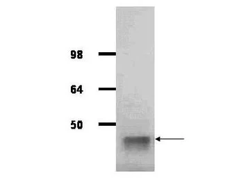 Anti-Aldolase A antibody used in Western Blot (WB). GTX26190