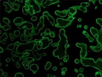 Anti-pan Cytokeratin antibody [PCK-26] used in IHC (Paraffin sections) (IHC-P). GTX26401