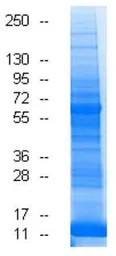 Human Placenta (Normal) tissue lysate. GTX27695