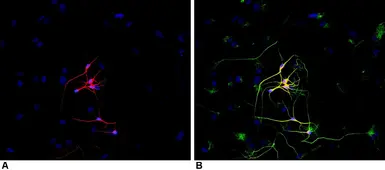 Anti-beta Tubulin 3/ Tuj1 antibody [TU-20] used in Immunocytochemistry/ Immunofluorescence (ICC/IF). GTX27751