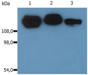 Anti-Integrin beta 1 / CD29 antibody [MEM-101A] used in Western Blot (WB). GTX28238