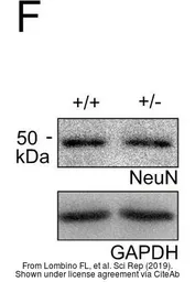 Anti-GAPDH antibody [6C5] used in Western Blot (WB). GTX28245