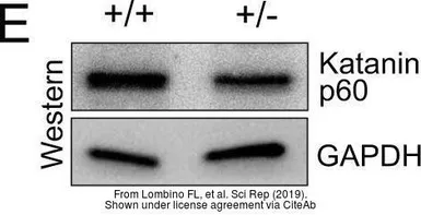 Anti-GAPDH antibody [6C5] used in Western Blot (WB). GTX28245