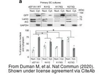 Anti-GAPDH antibody [6C5] used in Western Blot (WB). GTX28245