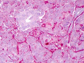 Anti-NOTCH1 antibody used in IHC (Paraffin sections) (IHC-P). GTX28925