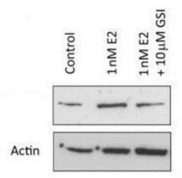 Anti-NOTCH1 antibody used in Western Blot (WB). GTX28925
