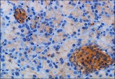 Anti-Somatostatin receptor 2 antibody used in IHC (Paraffin sections) (IHC-P). GTX29550