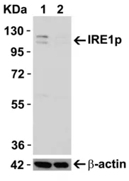 Anti-IRE1 alpha antibody used in Western Blot (WB). GTX30005