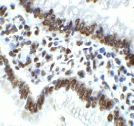 Anti-IRE1 alpha antibody used in IHC (Paraffin sections) (IHC-P). GTX30005