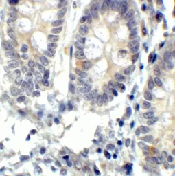 Anti-IRE1 alpha antibody used in IHC (Paraffin sections) (IHC-P). GTX30005