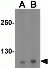 Anti-IRE1 alpha antibody used in Western Blot (WB). GTX30005