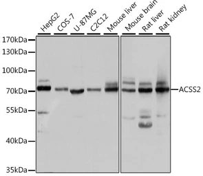 Anti-ACSS2 antibody used in Western Blot (WB). GTX30020