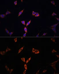 Anti-ACSS2 antibody used in Immunocytochemistry/ Immunofluorescence (ICC/IF). GTX30020