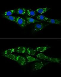 Anti-ACSS2 antibody used in Immunocytochemistry/ Immunofluorescence (ICC/IF). GTX30020