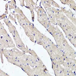 Anti-ACSS2 antibody used in IHC (Paraffin sections) (IHC-P). GTX30020