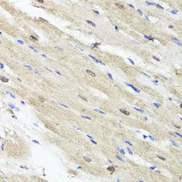 Anti-ACSS2 antibody used in IHC (Paraffin sections) (IHC-P). GTX30020