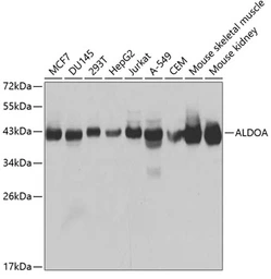 Anti-Aldolase A antibody used in Western Blot (WB). GTX30044