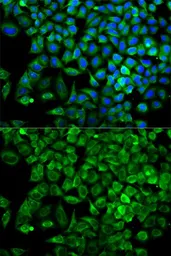 Anti-Aldolase A antibody used in Immunocytochemistry/ Immunofluorescence (ICC/IF). GTX30044