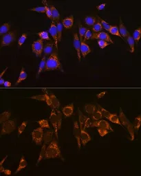 Anti-ATG3 antibody used in Immunocytochemistry/ Immunofluorescence (ICC/IF). GTX30073