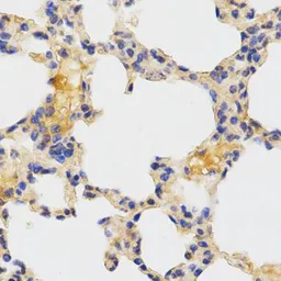 Anti-ATG3 antibody used in IHC (Paraffin sections) (IHC-P). GTX30073