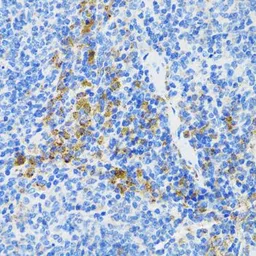 Anti-ATG3 antibody used in IHC (Paraffin sections) (IHC-P). GTX30073