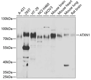 Anti-Ataxin 1 antibody used in Western Blot (WB). GTX30078