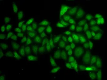 Anti-Ataxin 1 antibody used in Immunocytochemistry/ Immunofluorescence (ICC/IF). GTX30078