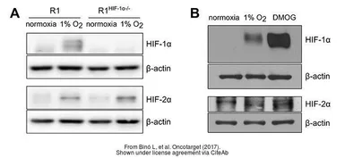 Anti-HIF2 alpha antibody used in Western Blot (WB). GTX30114