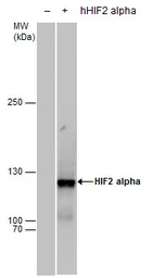 Anti-HIF2 alpha antibody used in Western Blot (WB). GTX30114