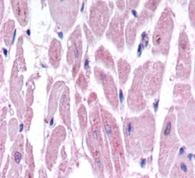 Anti-HIF2 alpha antibody used in Immunohistochemistry (IHC). GTX30114