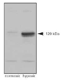 Anti-HIF2 alpha antibody used in Western Blot (WB). GTX30114