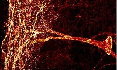 Anti-Neurokinin 1 Receptor antibody used in IHC (Paraffin sections) (IHC-P). GTX30169