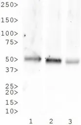 Anti-Neurokinin 1 Receptor antibody used in Western Blot (WB). GTX30183