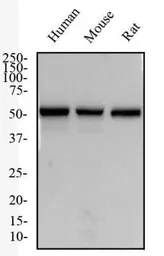 Anti-Neurokinin 1 Receptor antibody used in Western Blot (WB). GTX30183