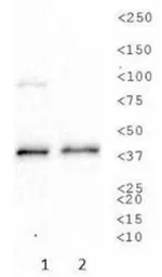 Anti-Sodium/Potassium ATPase beta 1 antibody [464.8(8A)] used in Western Blot (WB). GTX30203