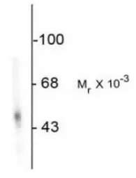 Anti-DOPA Decarboxylase antibody used in Western Blot (WB). GTX30448