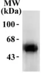 Anti-DOPA Decarboxylase antibody used in Western Blot (WB). GTX30448